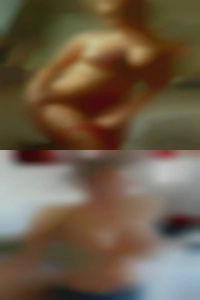 14 DD and adult no gag reflex.